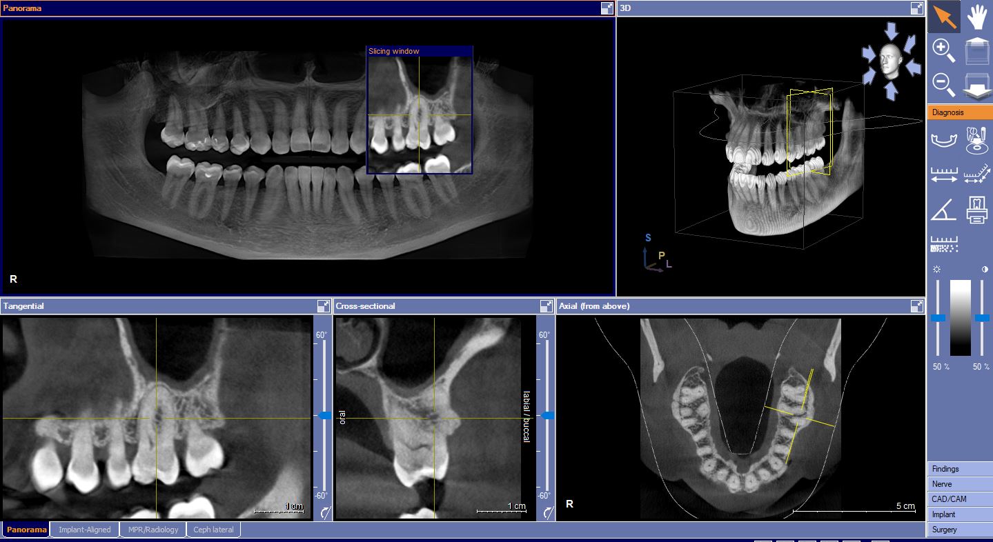 CBCT photo